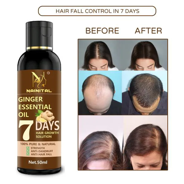 Nainital 7 Days Ginger Hair Oil - for Dandruff Care - Hair Regrowth - for  Women and Men Hair Oil (50 ml) PACK OF 1 - JioMart