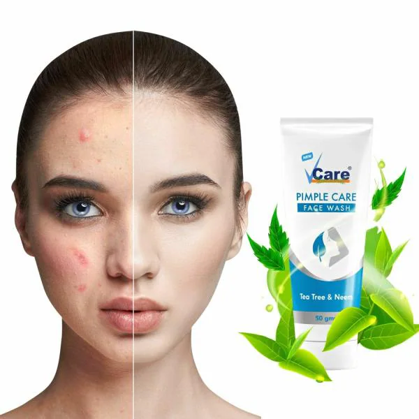 VCare Pimple Care Face Wash For Men and Women Anti Acne & Pimple