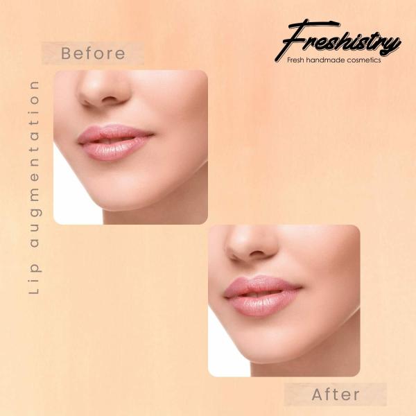 Freshistry Natural Lip Plumper For Women Peppermint & Cinnamon Oil