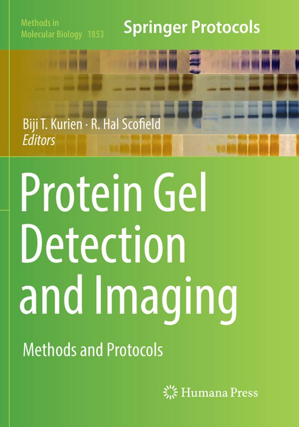 Protein Gel Detection and Imaging_UNKNOWN_Paperback_304 JioMart