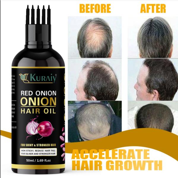 KURAIY pure Hair Fast Growth And Hair Care Essential Oil Natural Onion