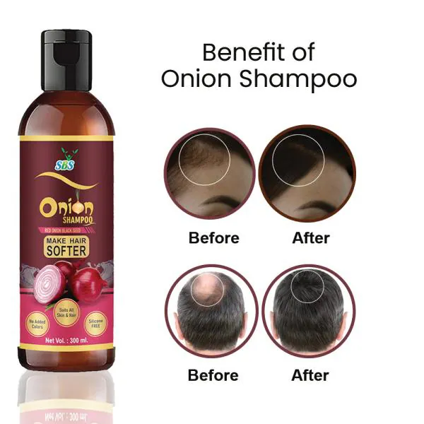 SBS Onion Shampoo - With Red Onion Extract, No Pungent Smell, Enhances Hair  Growth - 300ml - JioMart