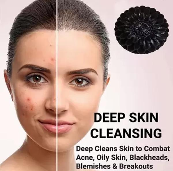Activated Charcoal Soap For Women Skin Whitening , Pimples, Blackheads