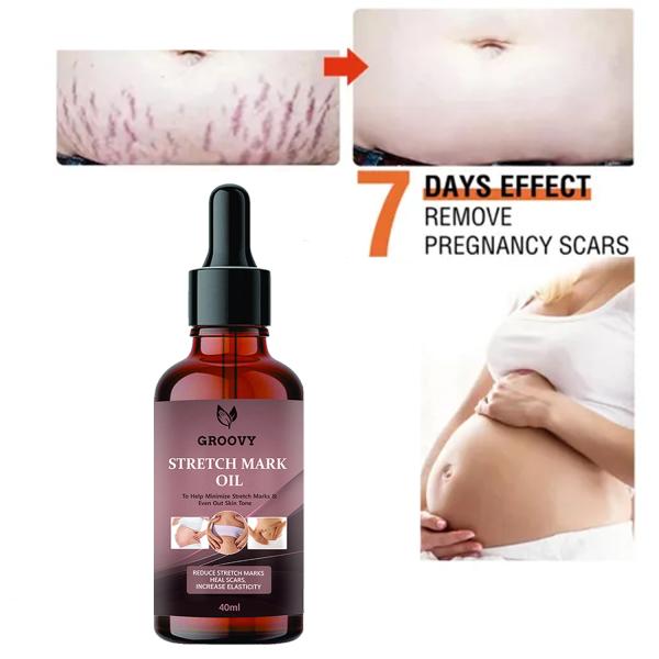 Groovy Skincare Oil for Pregnancy Stretch Marks with Argan Oil Saffron