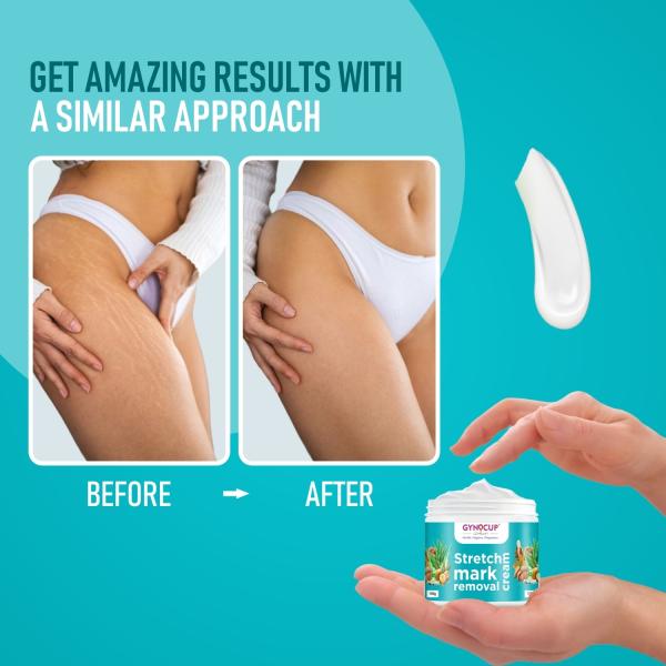 Gynocup Stretch Marks Removal Cream for Pregnancy Goodness of Shea
