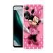 Draxon Vivo Y200e 5G, V2336 Mickey Mouse Printed Back Cover (10 x 3 x 20 cm)