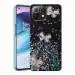 SROCK Mi 11 Lite NE 5G, Mi 11 Lite Back Case Cover for Girls | Sparkle Glitter | Stylish for Ladies Women Back Case Cover for Mi 11 Lite NE 5G, Mi 11 Lite-Black