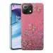 SROCK Mi 11 Lite NE 5G, Mi 11 Lite Back Case Cover for Girls | Sparkle Glitter | Stylish for Ladies Women Back Case Cover for Mi 11 Lite NE 5G, Mi 11 Lite-Pink