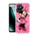 Draxon itel A70, A665L Mickey Mouse Printed Back Cover (10 x 3 x 20 cm)