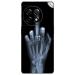 GADGETSWRAP Printed Vinyl Skin Sticker for Oneplus 11 - X Ray Hand