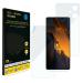 Gadgets Protector Xiaomi Poco F5 Transparent Thermoplastic Polyurethane Screen And Body Protector With Installation Kit 17.2L X 11.6W Cm (Set Of 2)