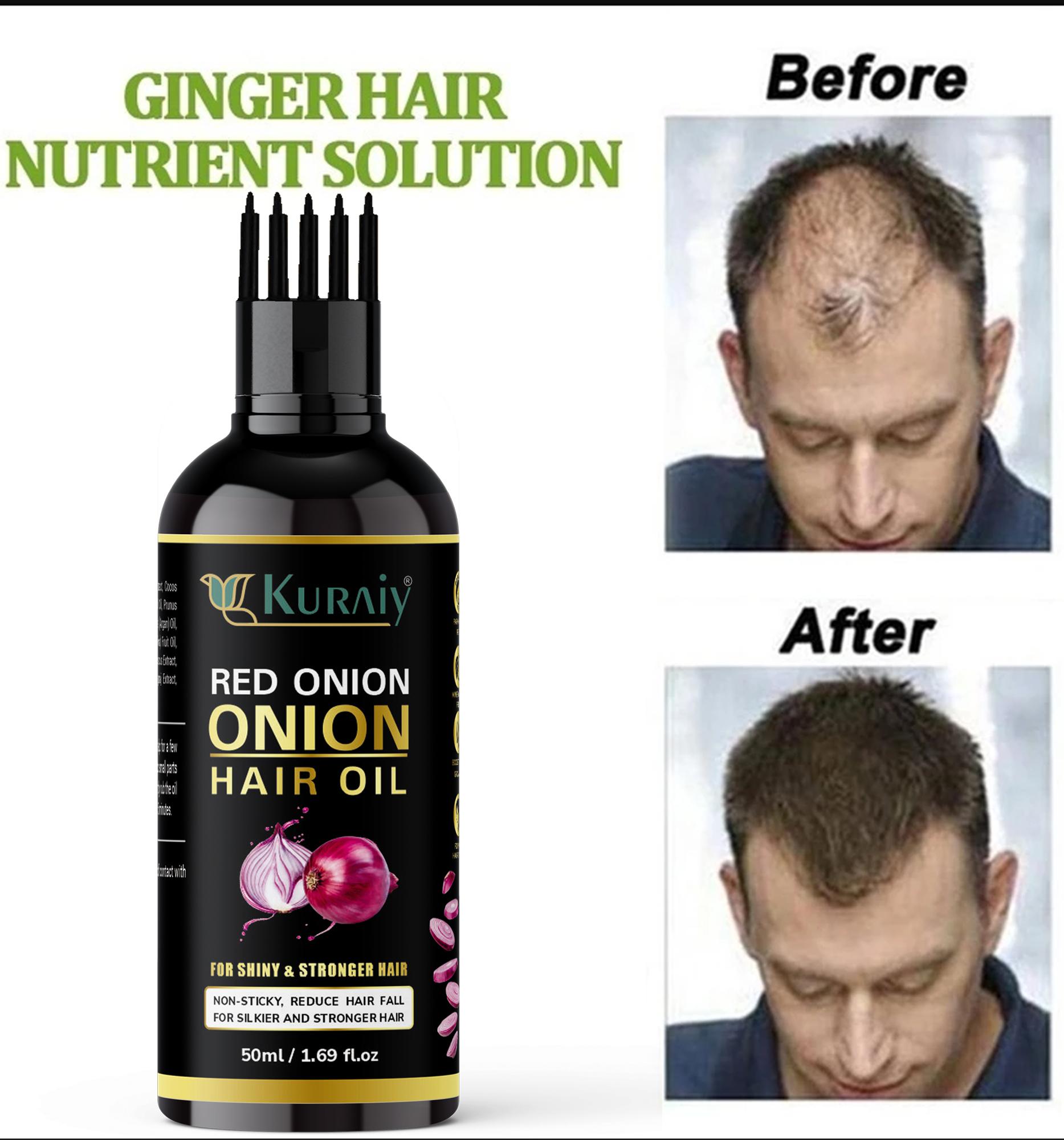 KURAIY Onion Black Seed Hair Oil Prevent Hair Loss Biotin Fast Hair Growth  Strong Hair Growth Spray Hair Treatment for Dry Damaged Hair - JioMart