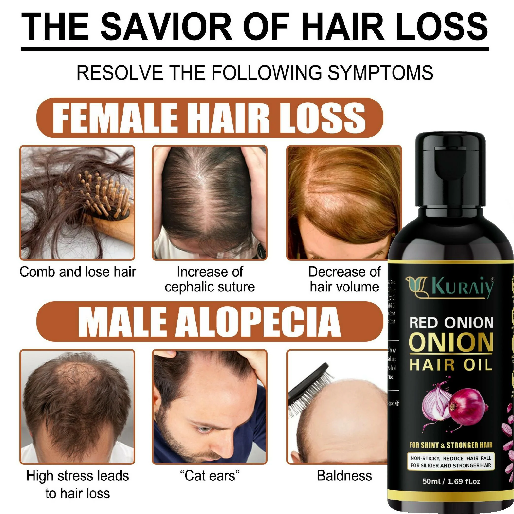 KURAIY Natural Onion Black Seed Hair Oil Spray For Hair Care And Growth Prevent  Hair Loss Biotin Fast Hair Growth Essential Oils (50 ml ) & (MEN & WOMEN) -  JioMart