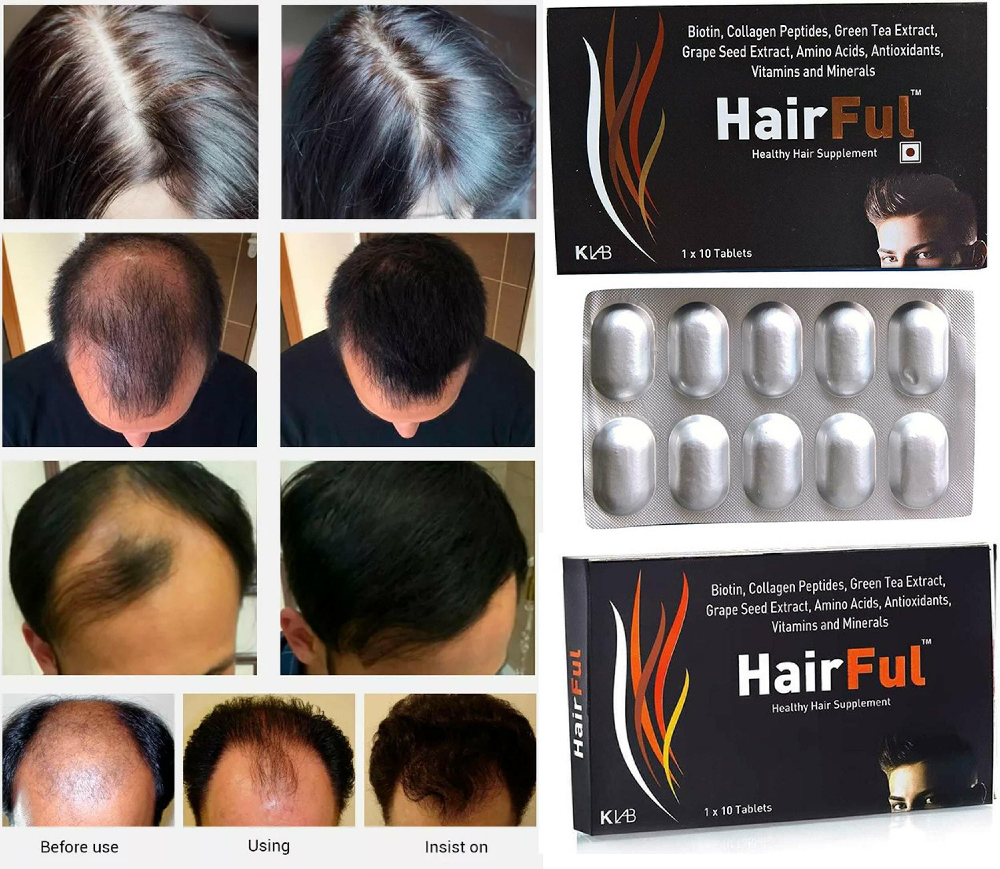 HairFul Healthy Hair Supplement Price in India  Buy HairFul Healthy Hair  Supplement online at Flipkartcom
