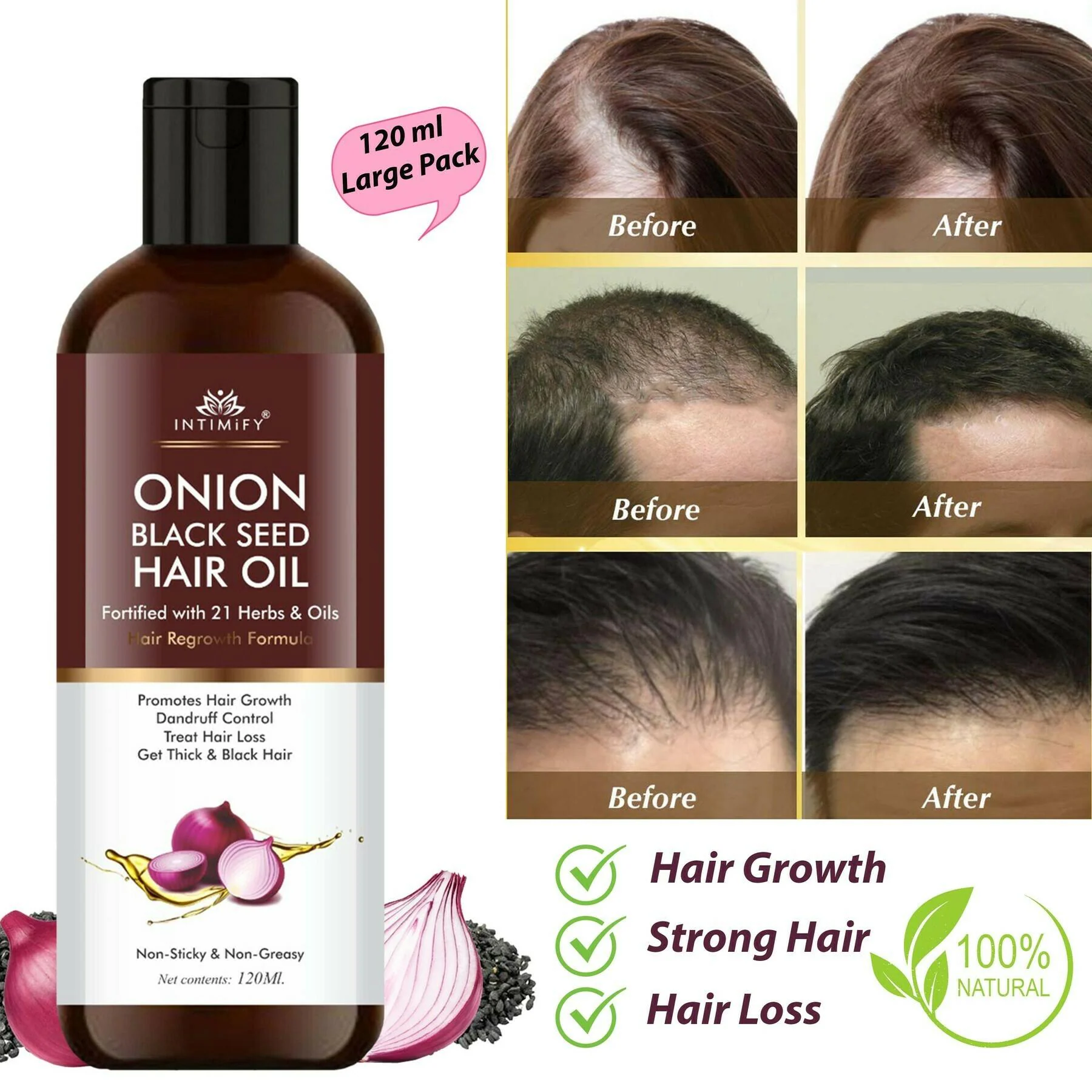 Intimify Onion Black Seed Hair Oil for black hair, hair growth, strong hair,  shiny hair, thick hair - JioMart