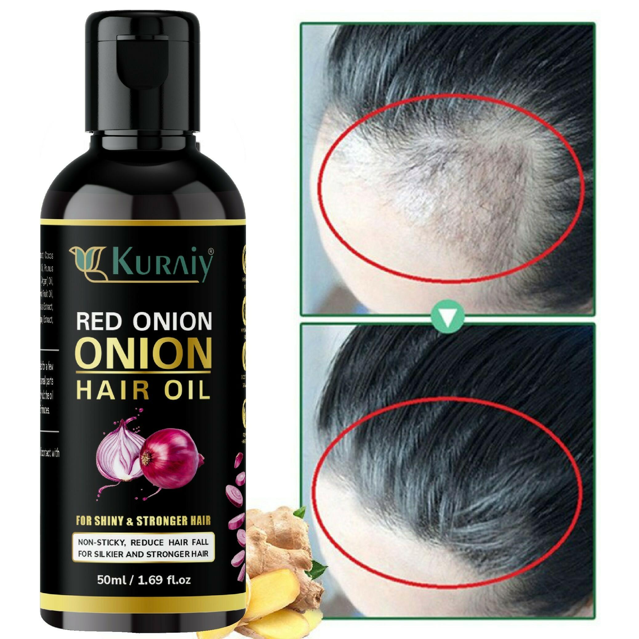KURAIY Red onion oil Hair Growth Products Hair Loss Care Essential Oils  Anti Dandruff Fast Growing Hair Oil Men Women Repair Treatment 50 ml -  JioMart