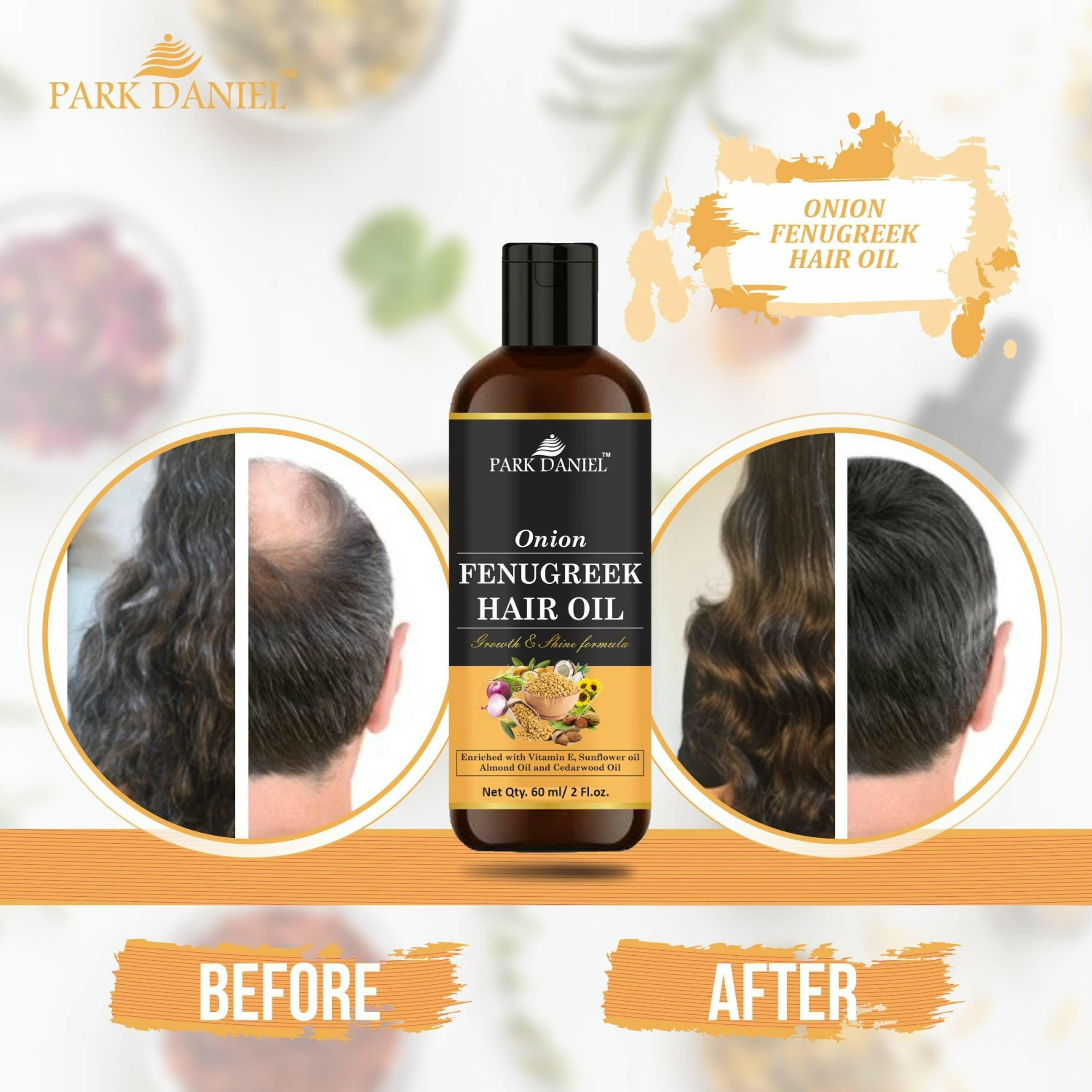 Park Daniel Onion Fenugreek Hair Oil Enriched With Vitamin E For Hair Growth  And Shine, 60 Ml - JioMart