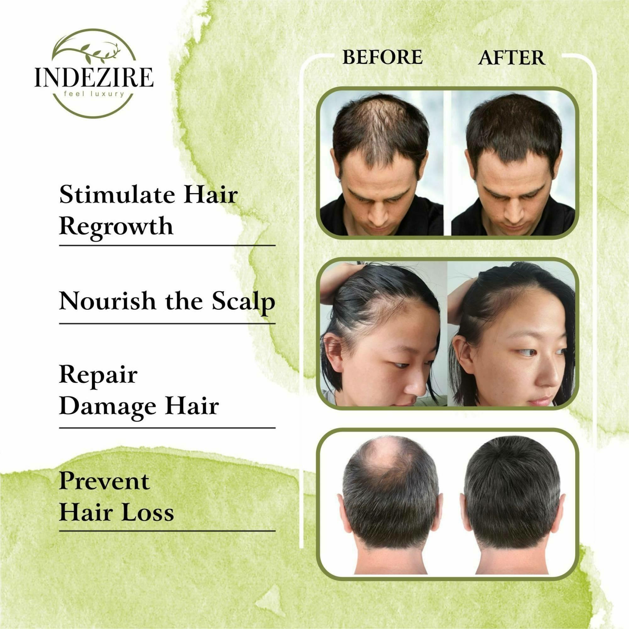 Update more than 84 natural hair growth treatment latest in.eteachers