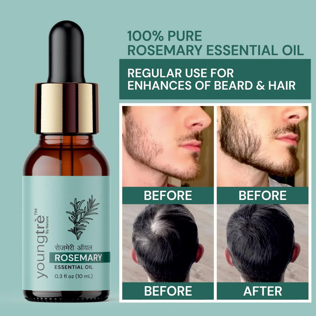 Youngtre Rosemary Beard Oil Pure Organic for Natural Shiny Dense Beard Hair  Growth & Moisturizing, Nourishment Beard, Skin & Reduce Acne, Pimple, Dark  Circles-10 ML - JioMart